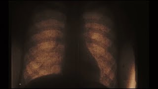 Type 9000 Music Video