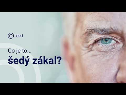 Náhled pro video reference