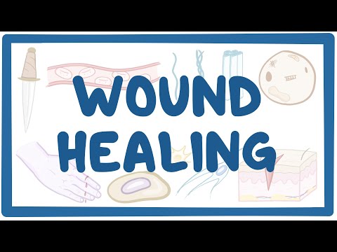 Wound healing