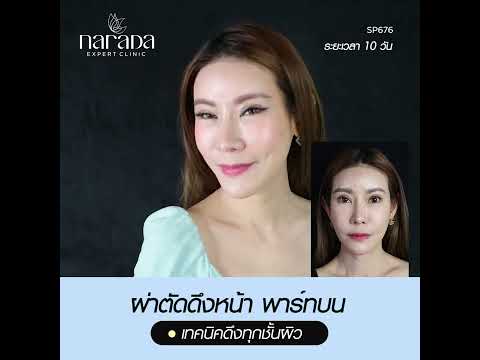 "ล็อกผิวตึง ล็อคความสวย ในวัย 40+ ” ENDO-FACELOCK นารดาคลินิก