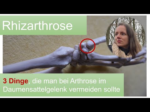 Rhizarthrose - 3 Dinge, die man bei Daumensattelgelenksarthrose vermeiden sollte