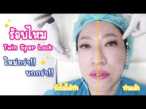 ร้อยไหม
