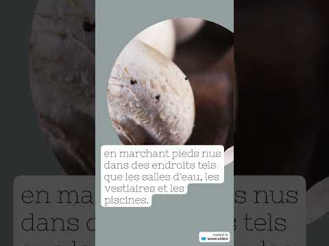 Vidéo : mycose des pieds par le Dr Rousseau