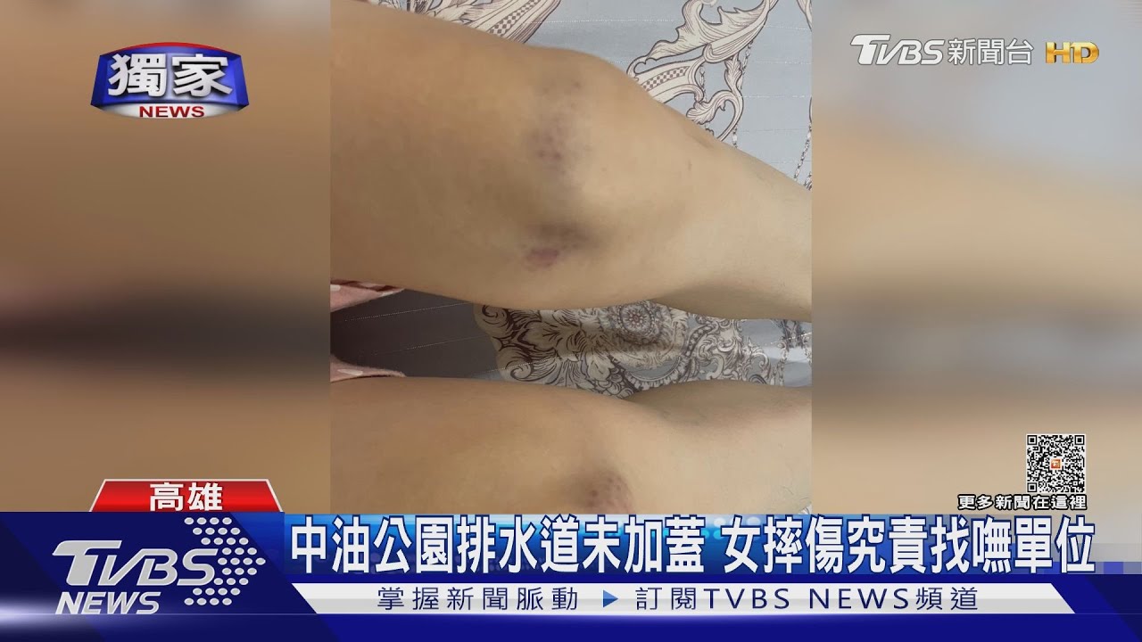 最美港灣公園掉漆!中油公園排水道未加蓋 女摔傷找嘸究責