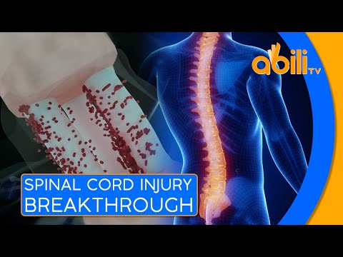 Breakthrough in Spinal Cord Repair: Australian Scientists ...