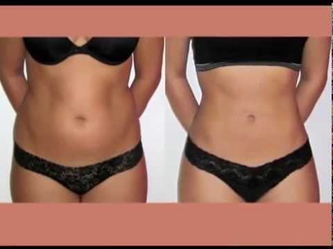 Slimming suit bumili ng murang Moscow Kung paano mawalan ng timbang sa pamamagitan ng 3 kg Tips
