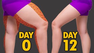 INNER THIGH + OUTER THIGH FAT | DO THIS FOR 12 DAYS