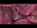 'https://youtu.be/F9v' 글에 포함된 동영상