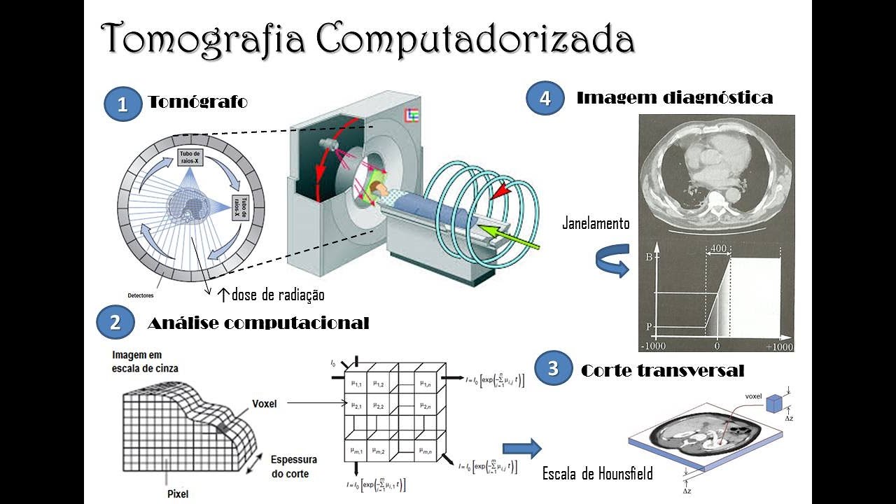 Tomografia Computadorizada - Tópicos gerais