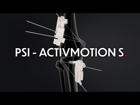 Patient Specific Instrumentation for Tibial Osteotomy - Activmotion S