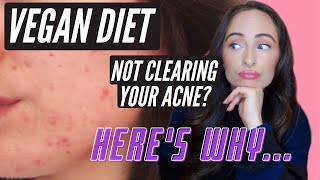 VEGAN DIET MAKING YOUR ACNE WORSE? HERES WHY (How 
