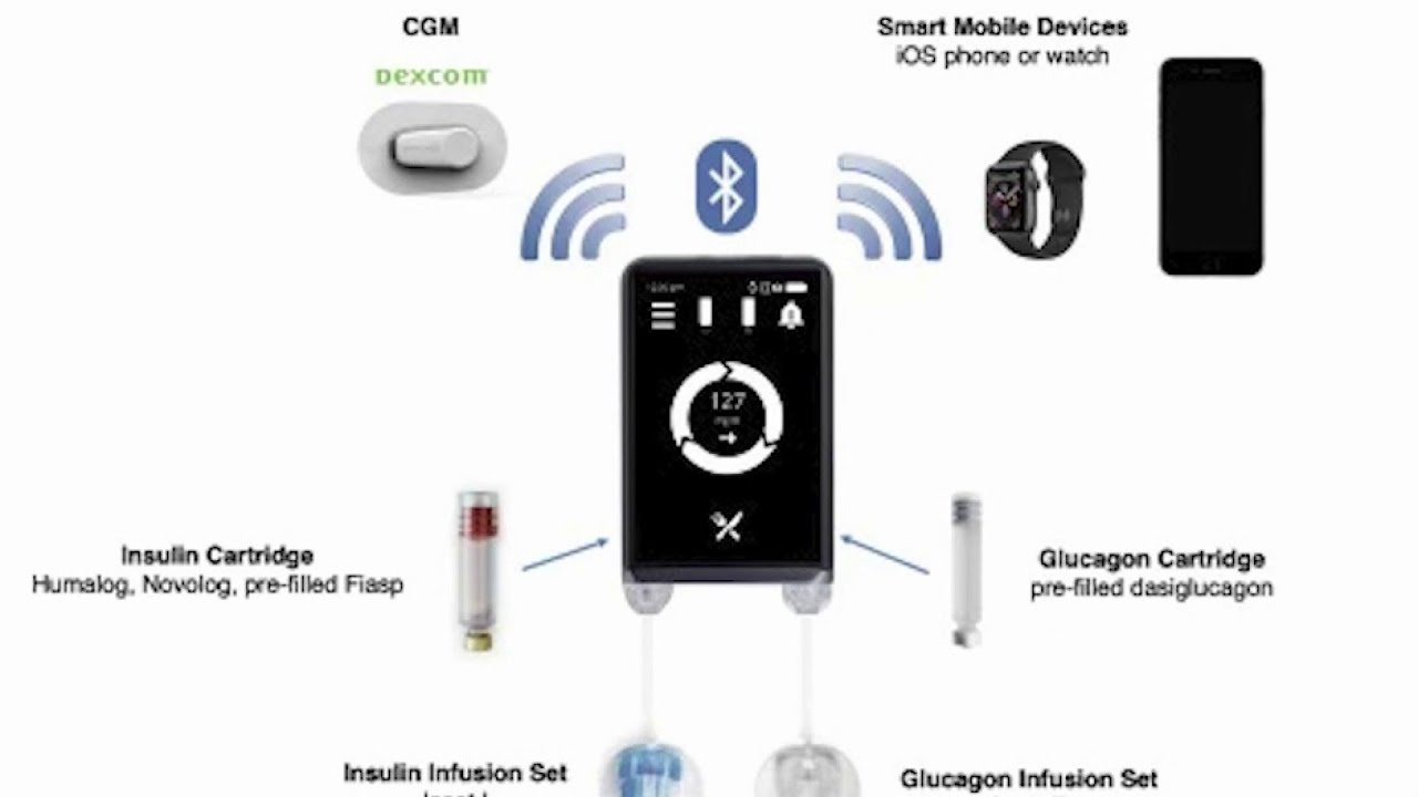 Bionic pancreas better than normal insulin deliver methods for Type 1 diabetes patients, study says