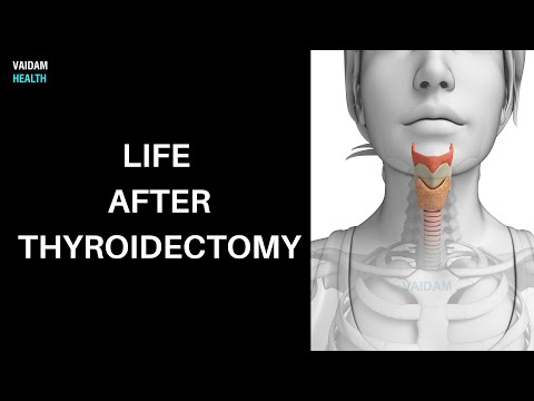 Life after Thyroidectomy