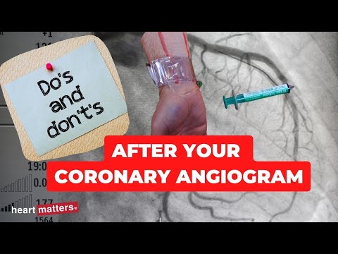 Post your coronary angiogram | What to know.