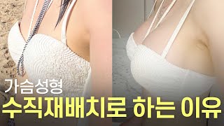 수직 재배치 가슴성형의 모든 것, 닥터 초이의 완벽한 가슴 라인 만들기 [JPN]