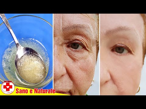 Usa Questa Maschera Fatta In Casa - Eliminare Le Rughe Dal Viso E Rassodare La Pelle Rapidamente