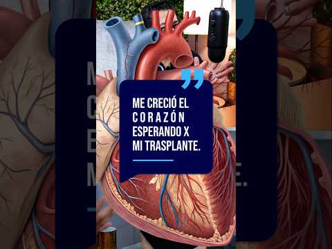 Mi corazón creció, mi cirugía de Trasplante fué de alto riesgo #TrasplanteRenal #CirugíaRenal #Salud