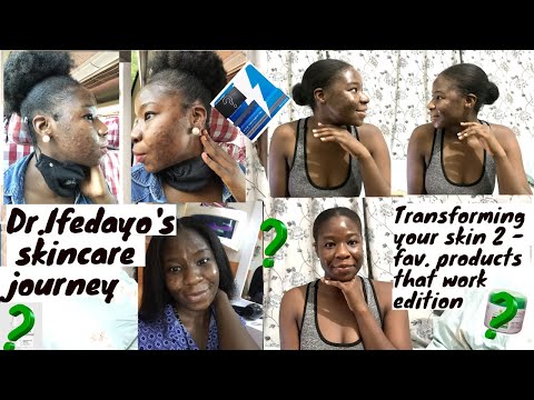 CURE SEVERE ACNE / PIMPLES! - Skincare with Dr Ifedayo - Healed To Heal