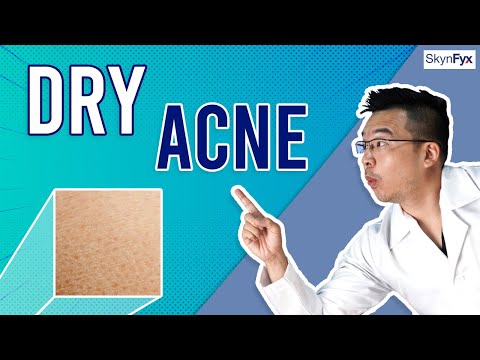 How To Treat Dry Skin + Acne (Dry Acne) | 5 Tips To Follow