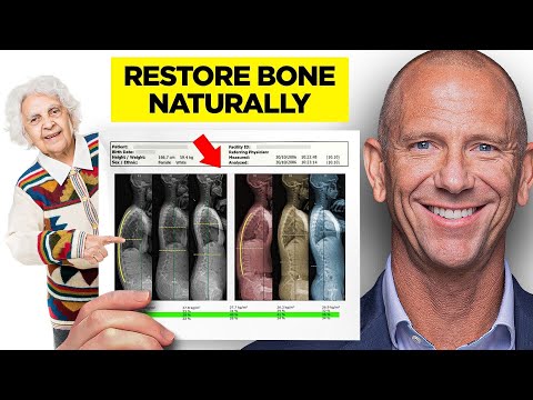 How This 70-Year-Old Woman Rebuilt Bone After 30 Years On Bone Drugs (Patient Success Story)