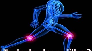 Te dueles las rodillas podrias tener artrosis