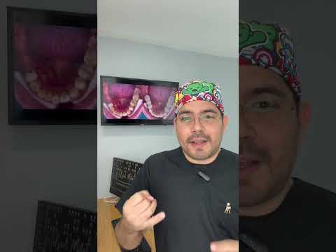 video FAkqRVZ4eA4