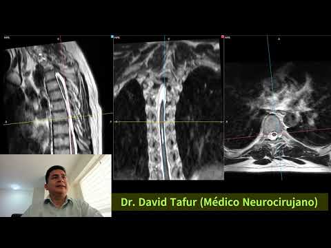 David Tafur Muñoz-3528
