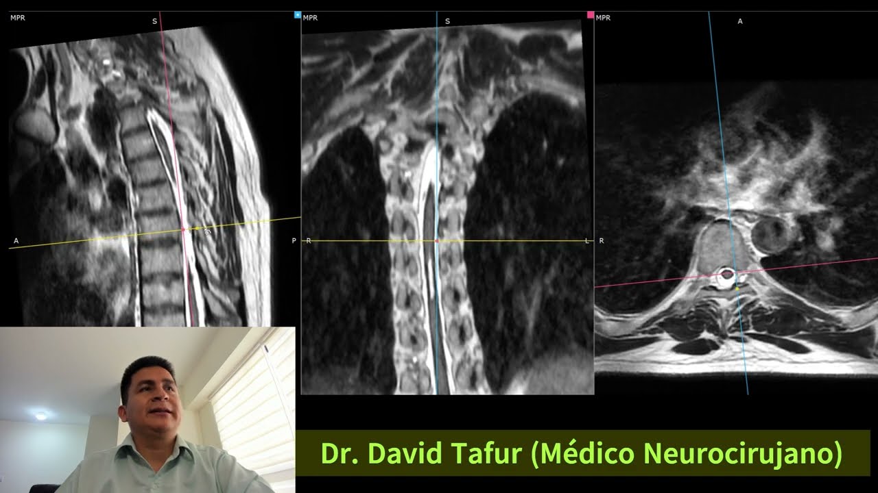 David Tafur Muñoz-2462