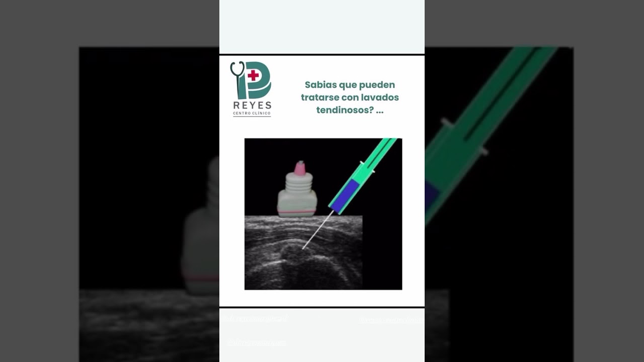 Josué Daniel Reyes Márquez-17