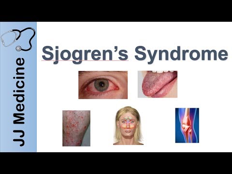 Fogyás sjogrens. Thymus carcinoma (M/3) Hogyan lehet fogyni a sjogren-szindrómán