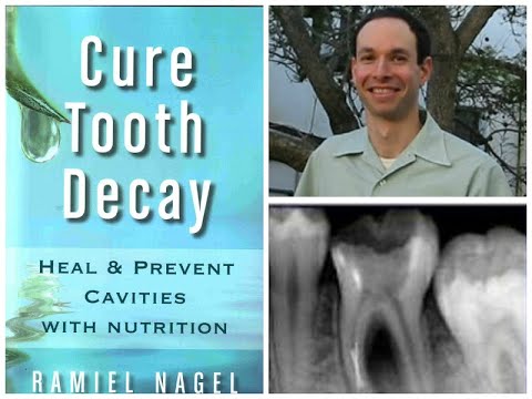 Cure Tooth Decay Book