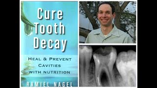 Author of Healing our Children and Cure Tooth Decay, researcher and dental advocate Ramiel Nagel.