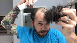 Is The Hair Coming Out Of The Other Side Of Your Hair Replacement or Hair System?  How To Fix It!