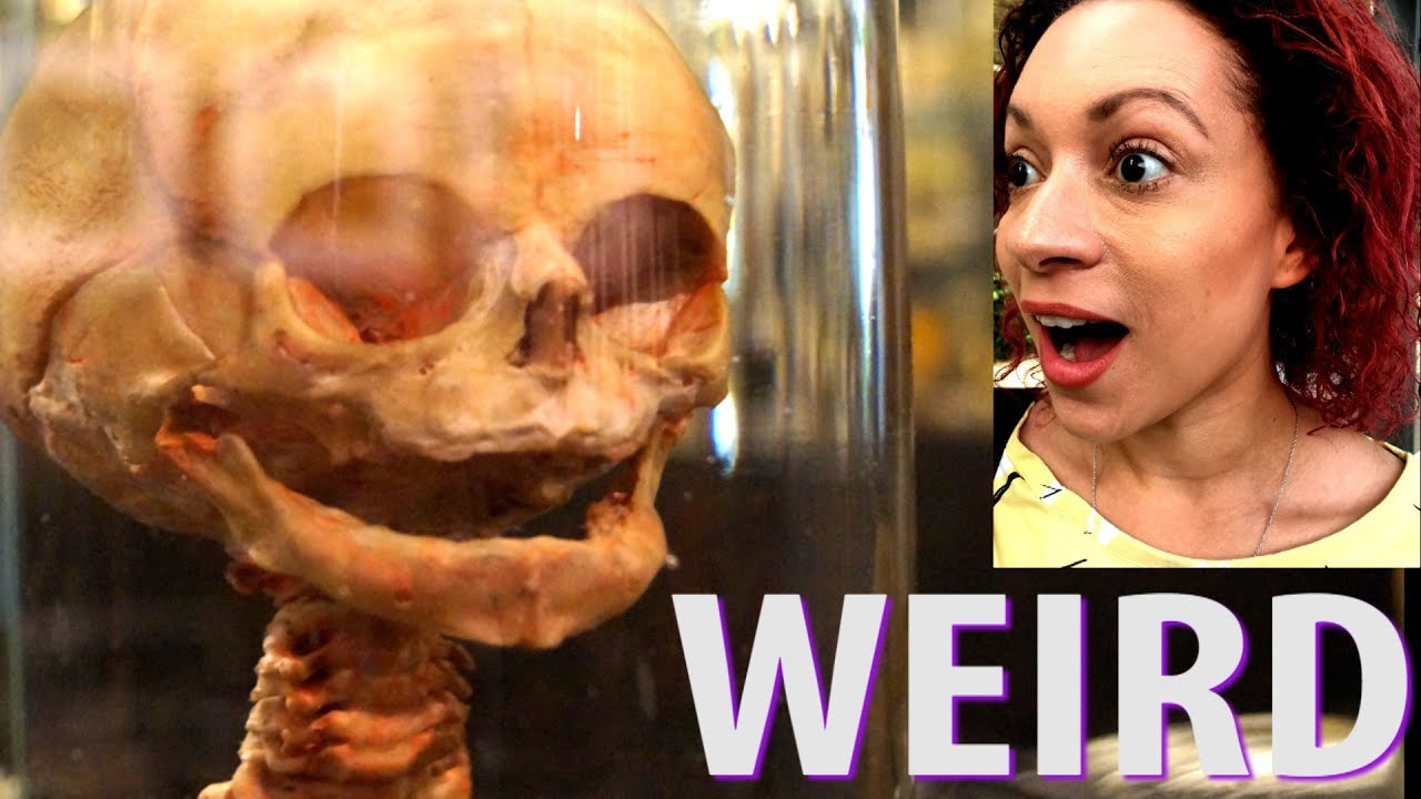 Undeniably, Museum Vrolik's collection is a thrilling spectacle, not intended for the easily unnerved!