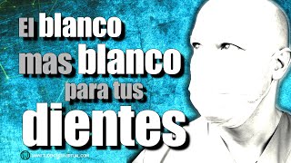 CARILLAS Y CORONAS DENTALES, LO QUE NO TE CUENTAN