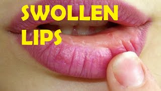 how to get rid of swollen lips after kissing