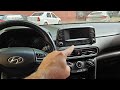 Head Unit Removal Guide Step By Step Hyundai Kona I30 I20 Etc