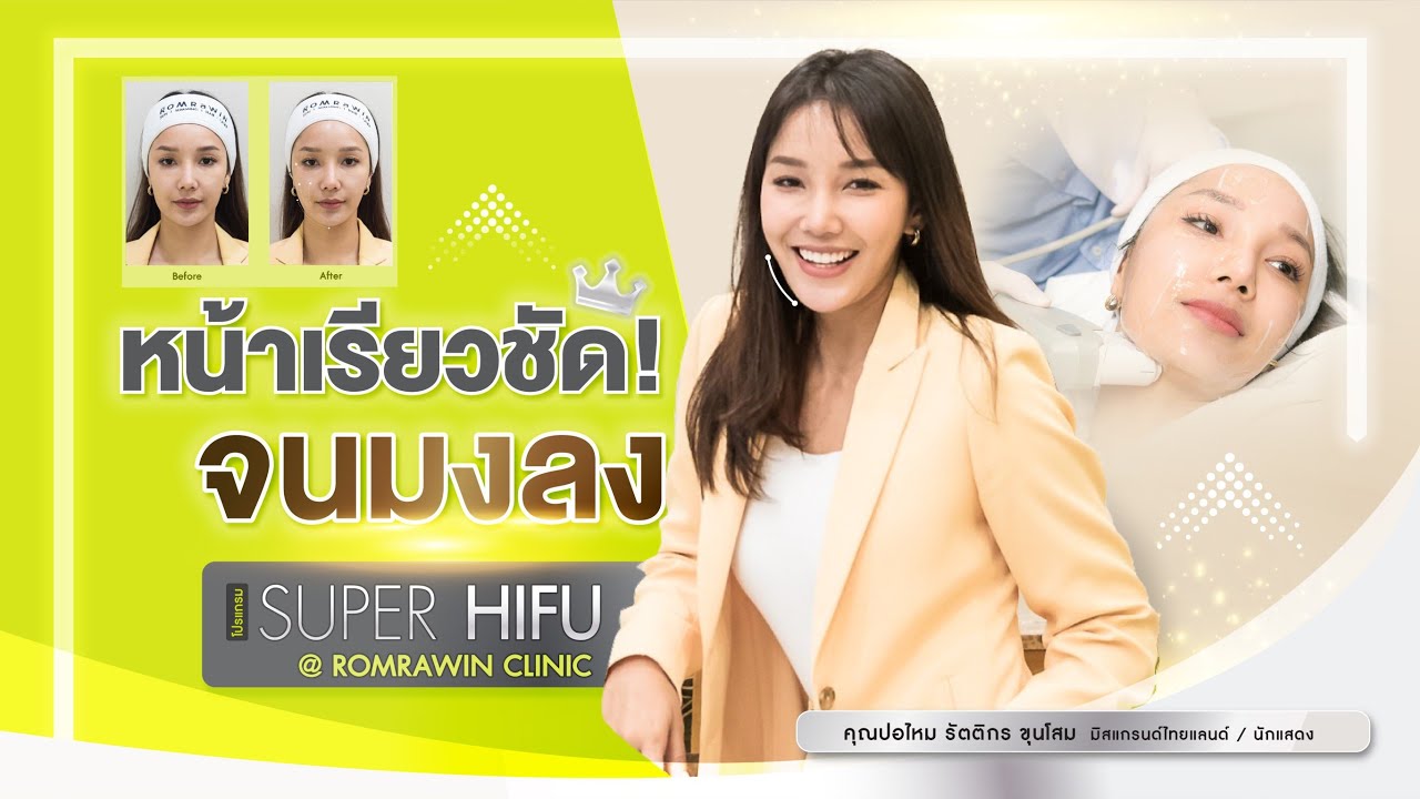 รีวิว Super Hifu ยกกระชับหน้าเรียว ลดแก้มและเหนียง กับคุณปอไหม วัตถกร