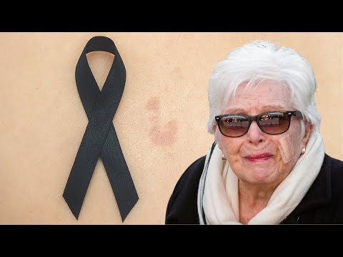 Bouleversant : Le combat de Line Renaud contre le cancer de la peau