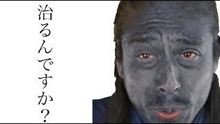 【悲惨】“ナスＤ”こと友寄ディレクターの肌が真っ黒になってしまった理由www