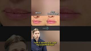 Lampert Md Plastic Surgery