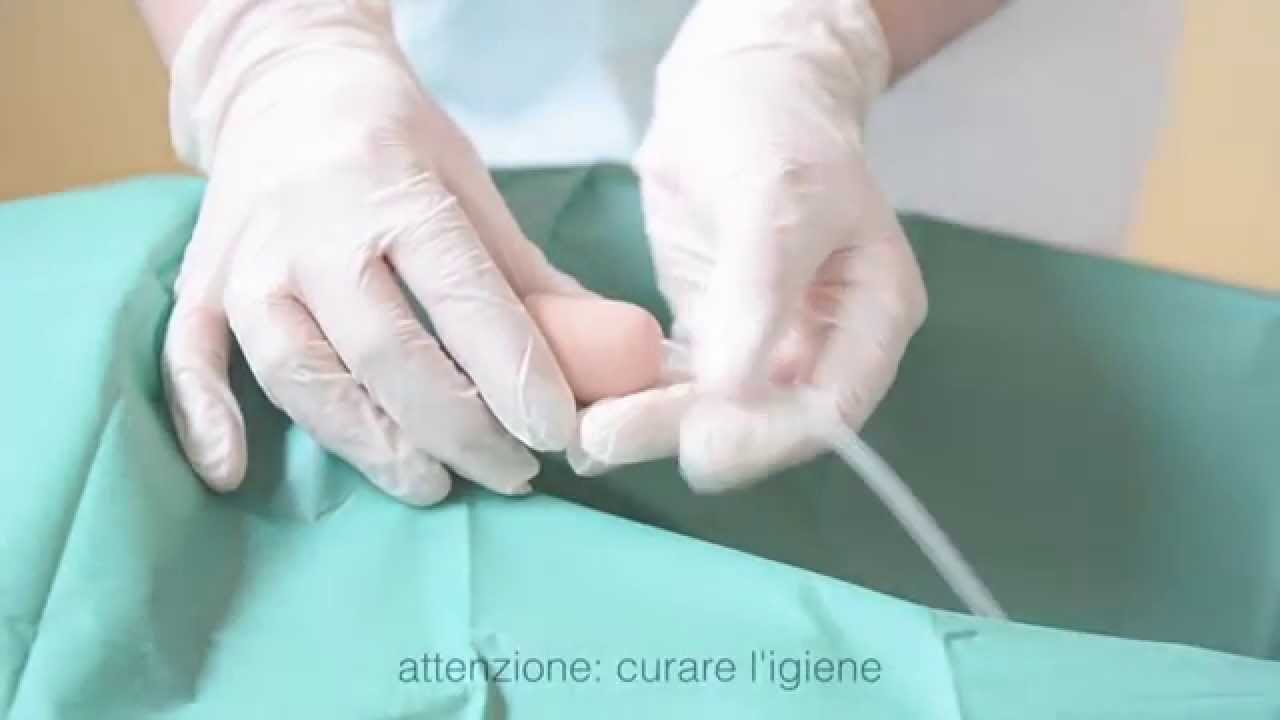 Ulss 1Belluno - Gestione del catetere vescicale a domicilio