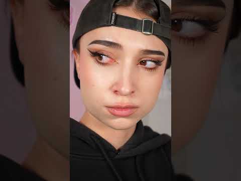 #pov : [PARTIE 4] L'amour rend aveugle 👀❤️‍🩹 #acting #cinematic #cinematography #prevention