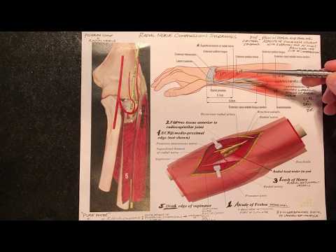 Radial Nerve Compression Syndromes (Radial Tunnel Syndrome/ Wartenberg Syndrome)