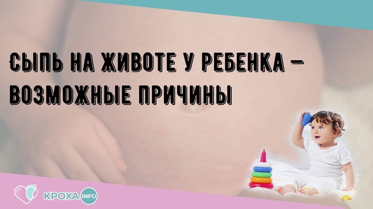 Сыпь на животе у ребенка — возможные причины