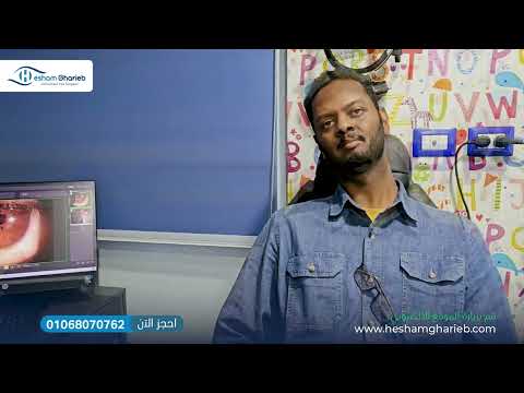 Glaucoma Patient Story 6
