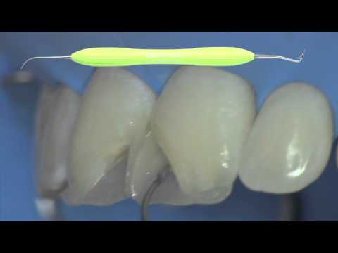 LM Arte - Meisterstücke gestalten (Lang version)