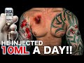 TRT Doctor Shares INSANE ANABOLIC ABUSE Stories & Shocking Side Effects (CREWCast Clips)