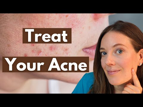 Acne Causes and Treatments | Dermatology Advice