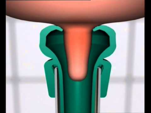 GEA Farm Technologies Milking Liner - ClassicPro